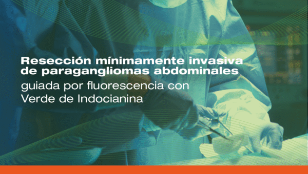 Resección mínimamente invasiva de paragangliomas abdominales guiada por fluorescencia con Verde de Indocianina