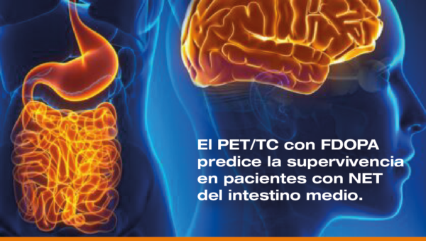 El PET/TC con FDOPA predice la supervivencia en pacientes con NET del intestino medio