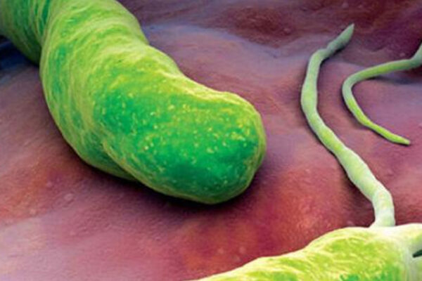 Úlceras Gástricas, Duodenal y Helicobacter Pylori