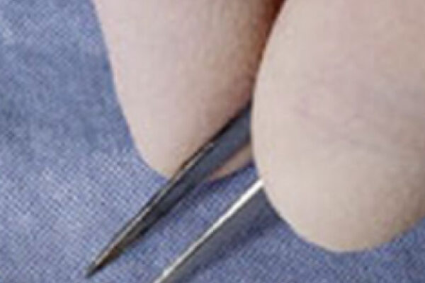 Proyecto Braquiterapia Prostática (Urología – Sanatorio Americano)