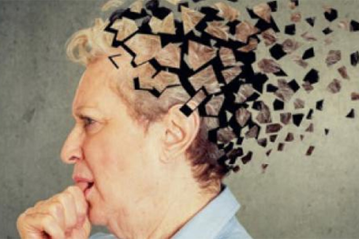 ¿Cuál es el rol de las imágenes funcionales en el manejo del mal de Alzheimer?